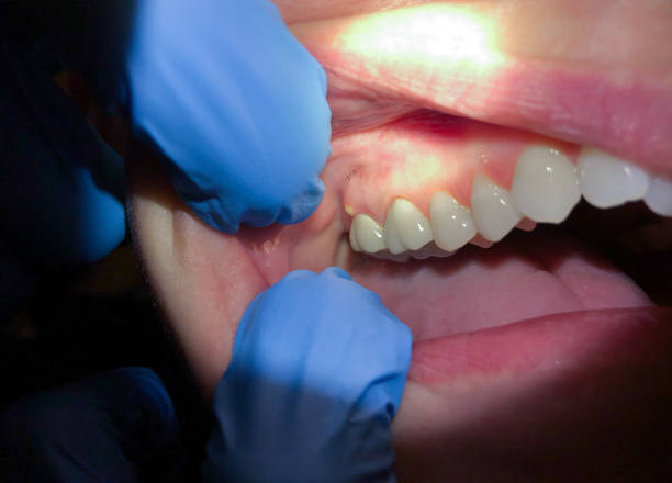 Best Broken Tooth Emergency  in Wrightsville, AR